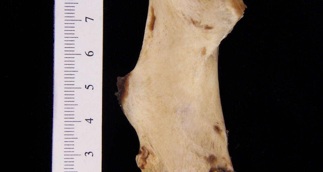 Beaver (Castor canadensis) left femur, posterior view
