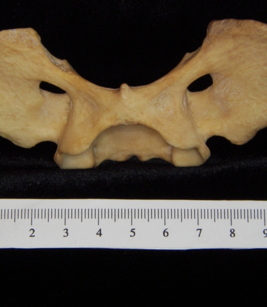 Dog (Canis lupus familiaris) C1 (1st cervical vertebra), inferior view