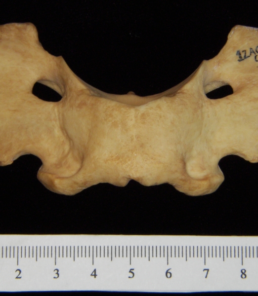 Dog (Canis lupus familiaris) C1 (1st cervical vertebra), superior view