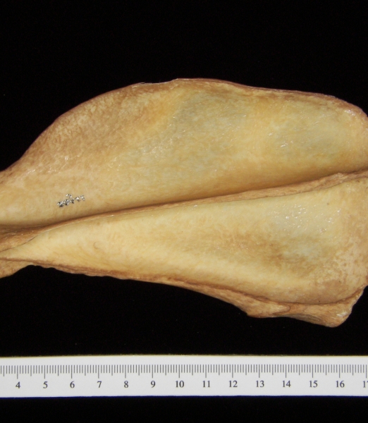 Dog (Canis lupus familiaris) left scapula, posterior view