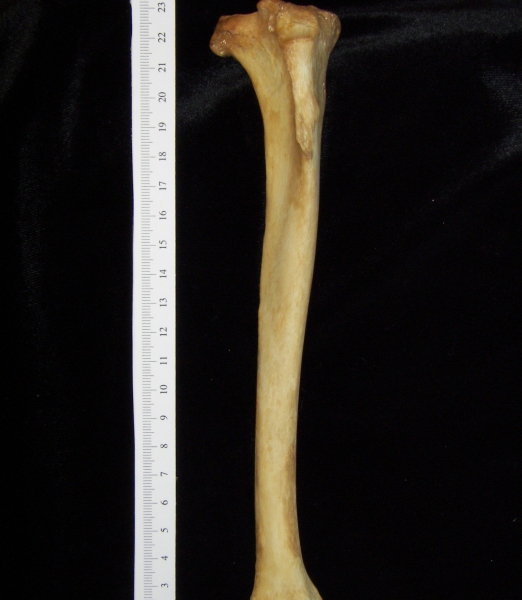 Dog (Canis lupus familiaris) right tibia, anterior view