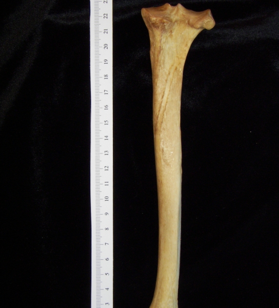 Dog (Canis lupus familiaris) right tibia, posterior view