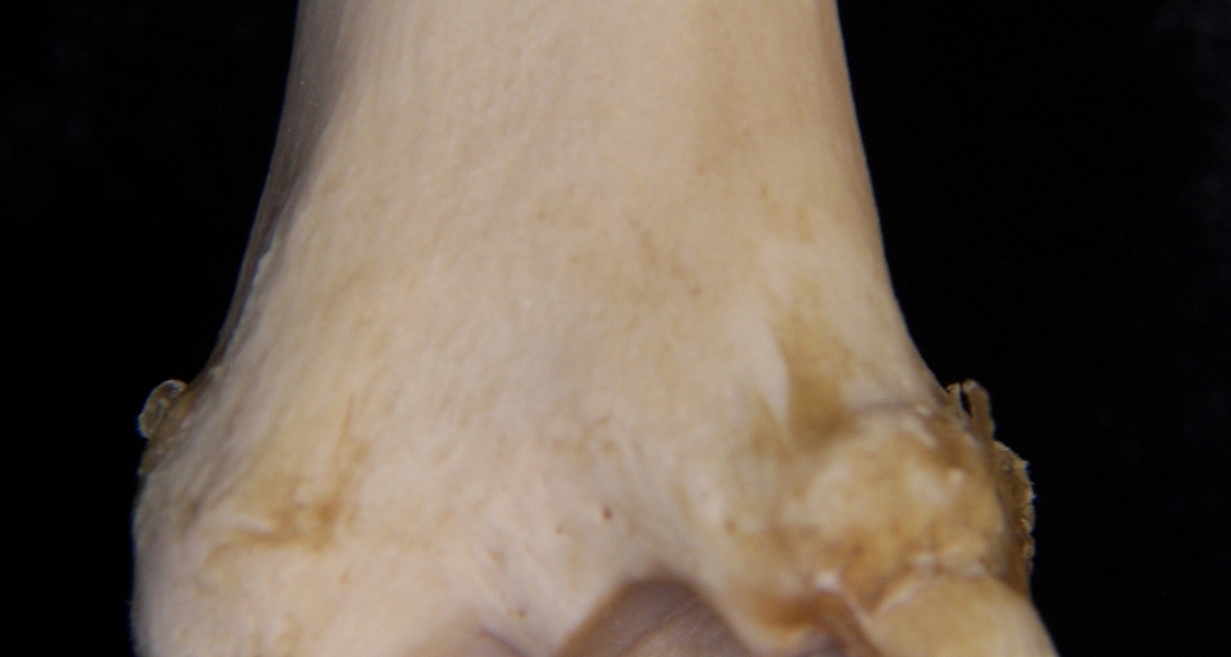 Domestic sheep (Ovis aries) right tibia, distal posterior aspect