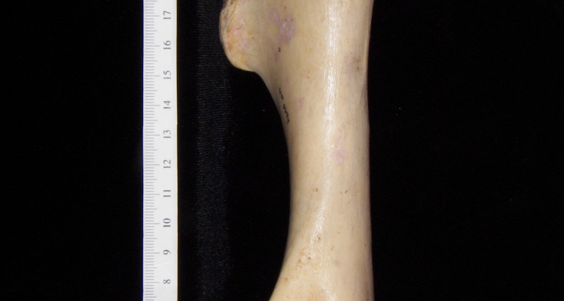 Horse (Equus caballus) left humerus, medial view