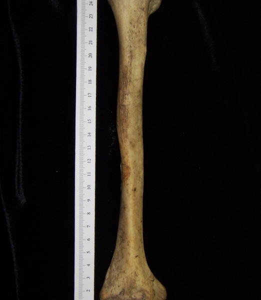 Human right humerus, lateral view