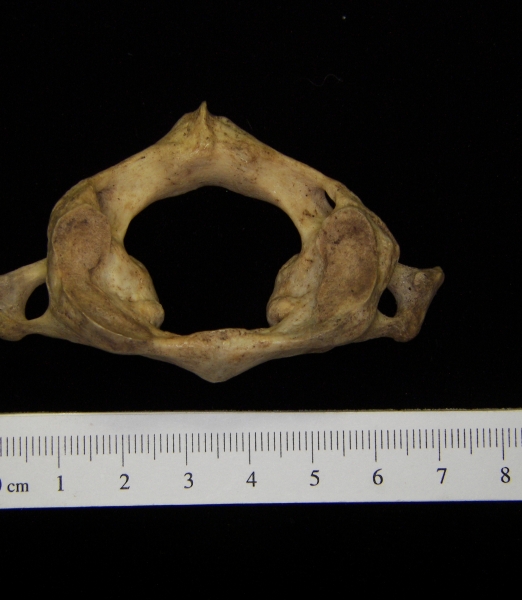 Human C1 (1st cervical vertebra), superior view