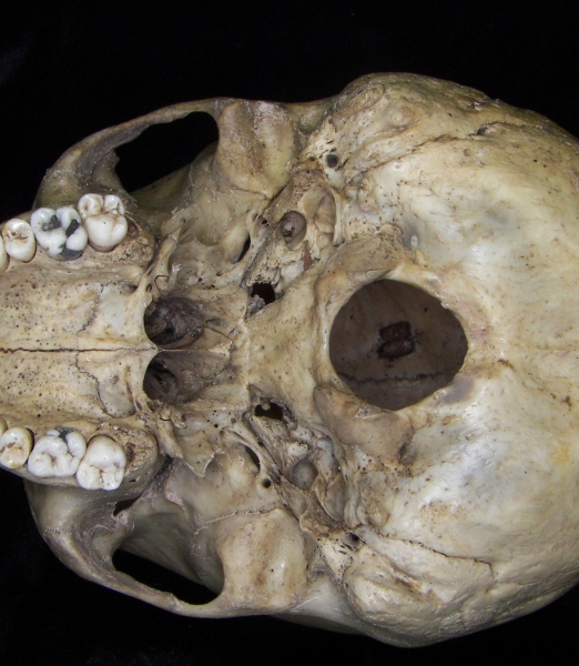 Human cranium, inferior view