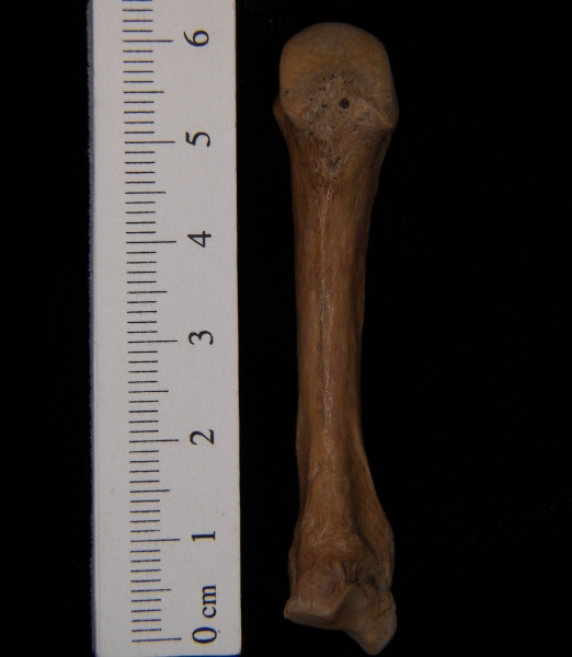 Human left 3rd metacarpal