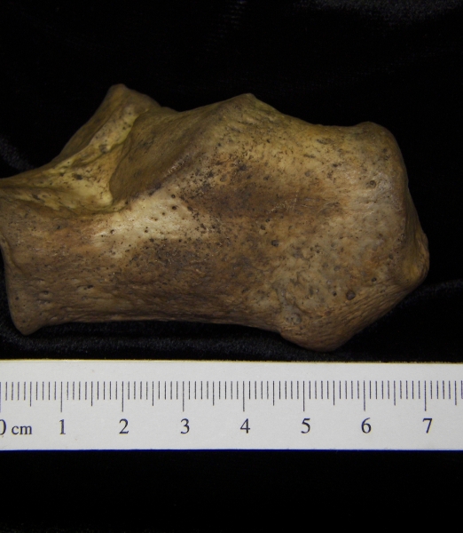 lateral View Left Human Calcaneus