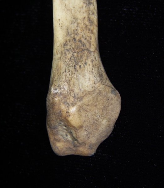 Human left fibula, distal aspect