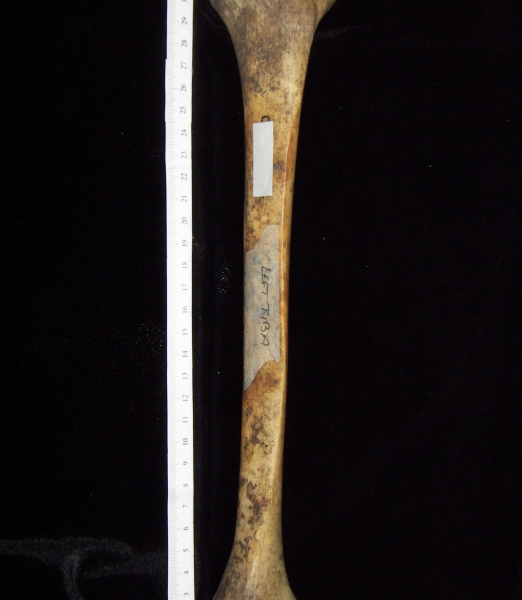 Human left tibia, anterior view