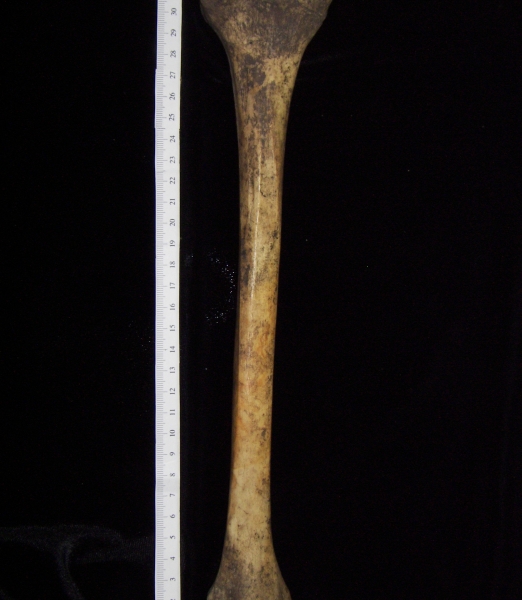 Human left tibia, posterior view