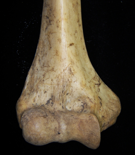 Human right humerus, distal aspect, view 2