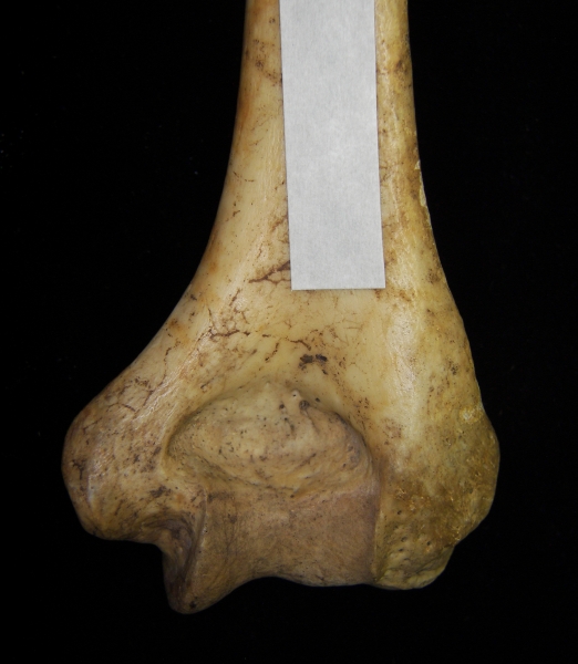 Human right humerus, distal aspect