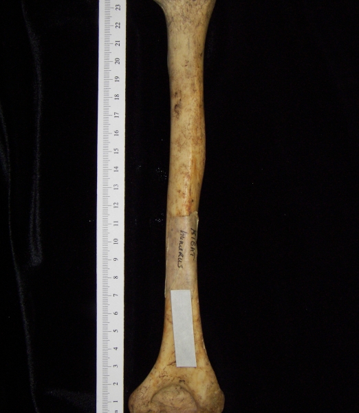 Human right humerus, posterior view