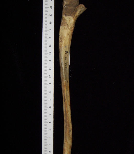 Anterior View Right Human Ulna