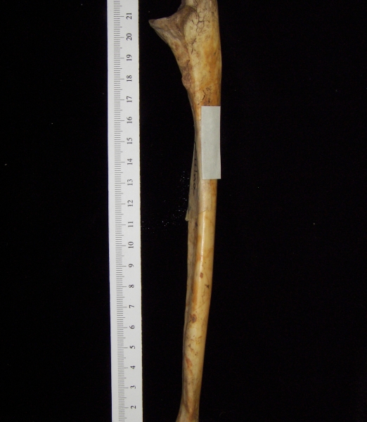 Lateral View Right Human Ulna