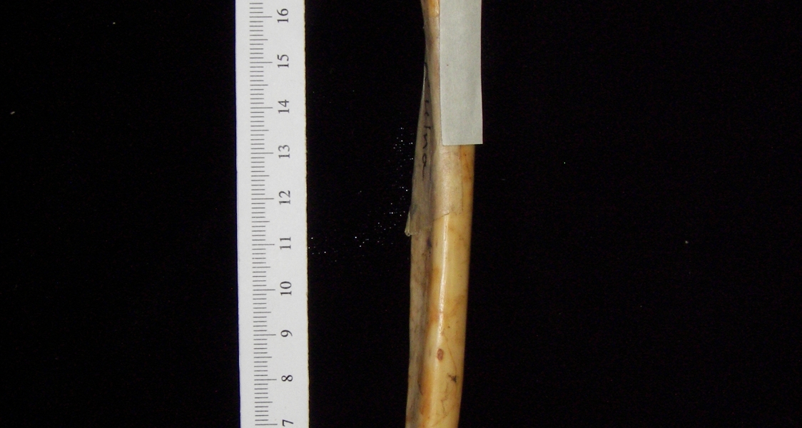 Lateral View Right Human Ulna