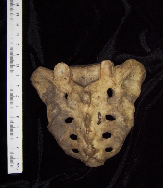 Posterior View Human Sacrum