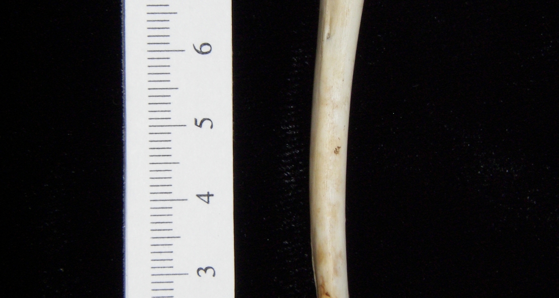 Opossum (Didelphis marsupialis) left tibia, posterior view