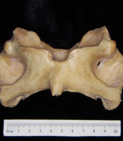 Pig (Sus scrofa) 1st cervical vertebra, inferior view