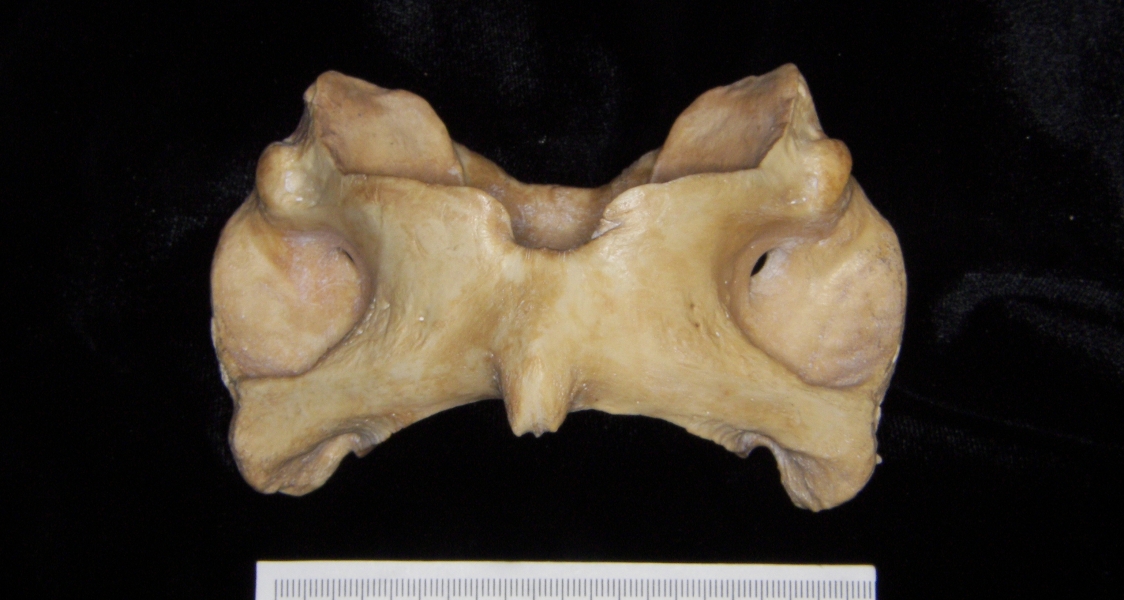 Pig (Sus scrofa) 1st cervical vertebra, inferior view