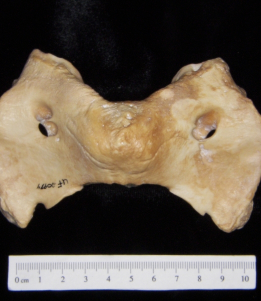 Pig (Sus scrofa) 1st cervical vertebra, superior view