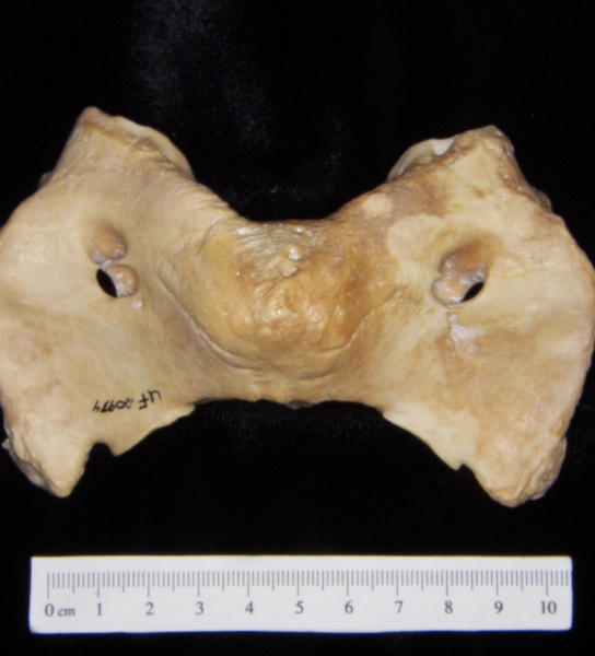 Pig (Sus scrofa) 1st cervical vertebra, superior view