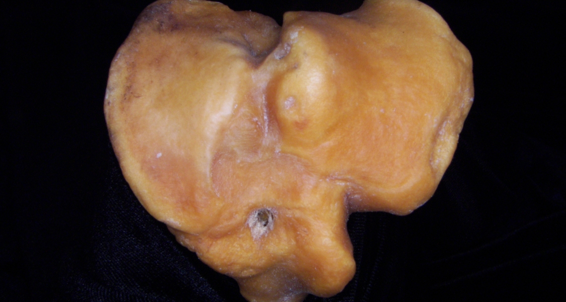 Pig (Sus scrofa) left tibia, proximal articular aspect