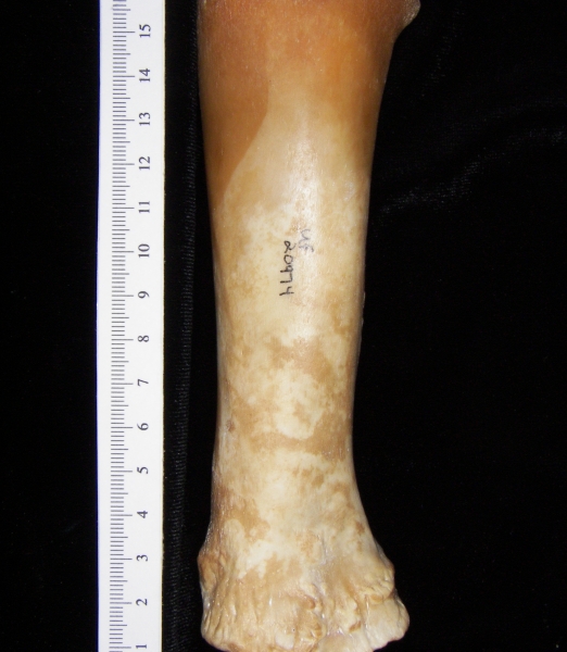 Pig (Sus scrofa) radius, anterior view