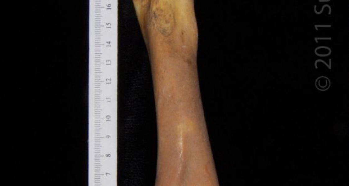 View 1 Alligator Femur