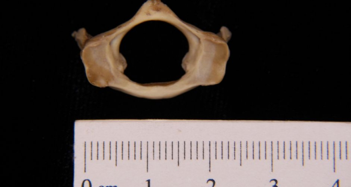 Anterior View Armadillo C1 Vertebrae