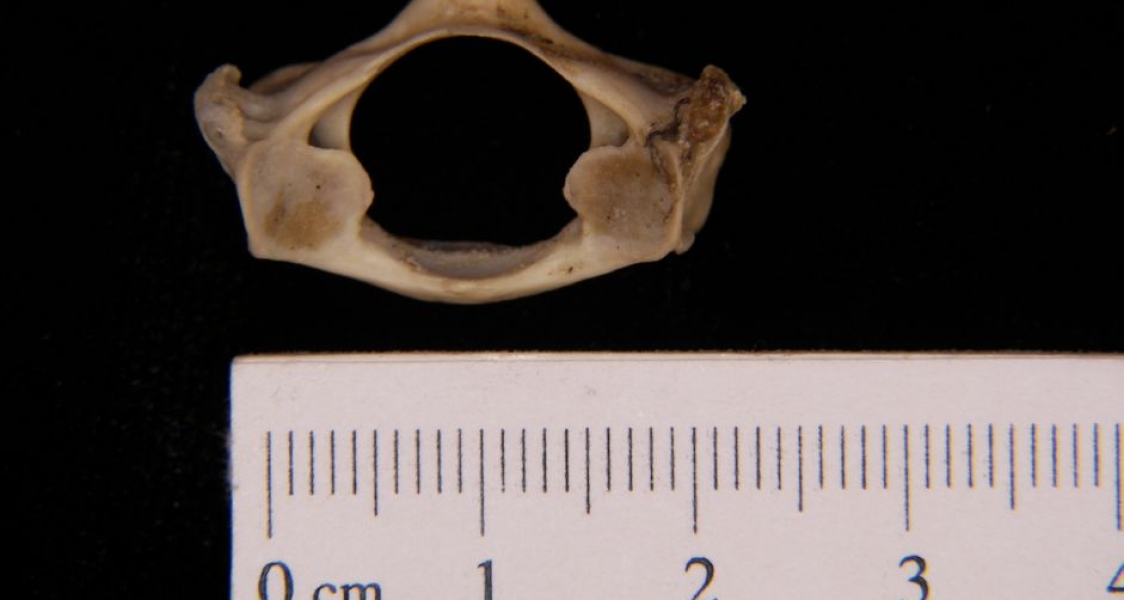 Posterior View Armadillo C1 Vertebrae