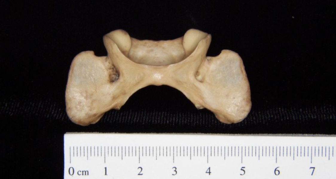 Inferior View Bobcat C1 Vertebrae