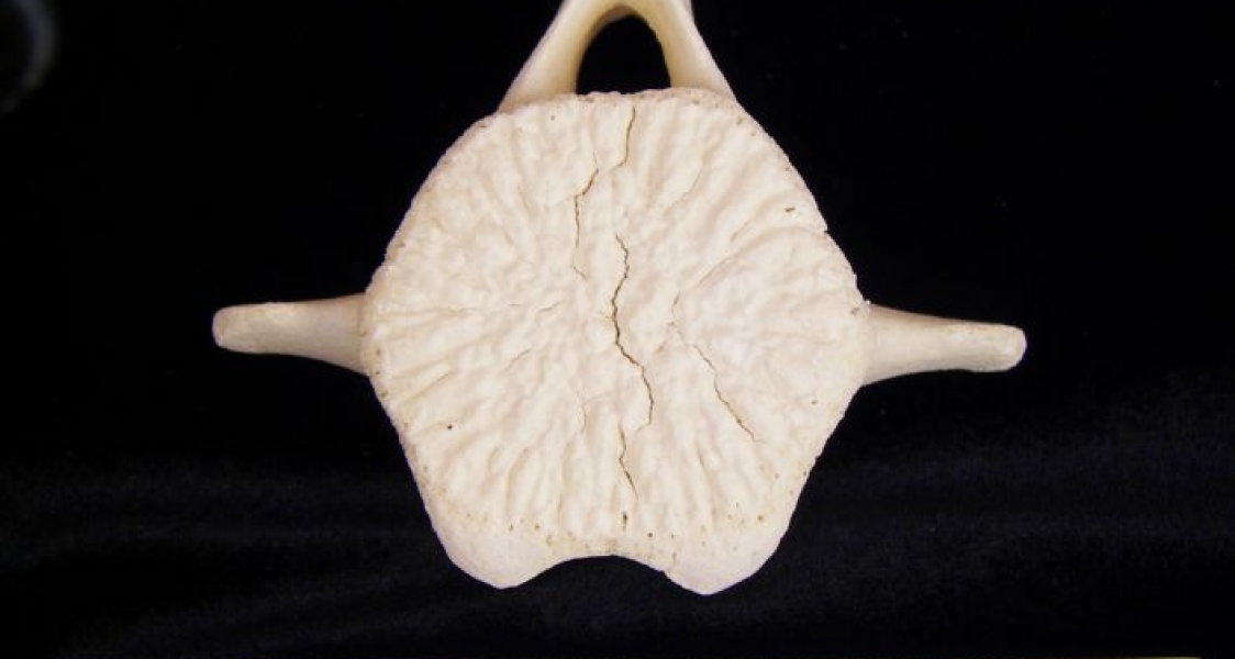 Bottlenose Dolphin Lumbar Vertebrae