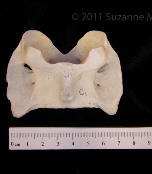 Inferior View Domestic Sheep C1 Vertebrae