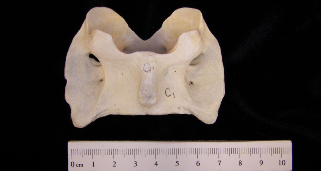 Inferior View Domestic Sheep C1 Vertebrae