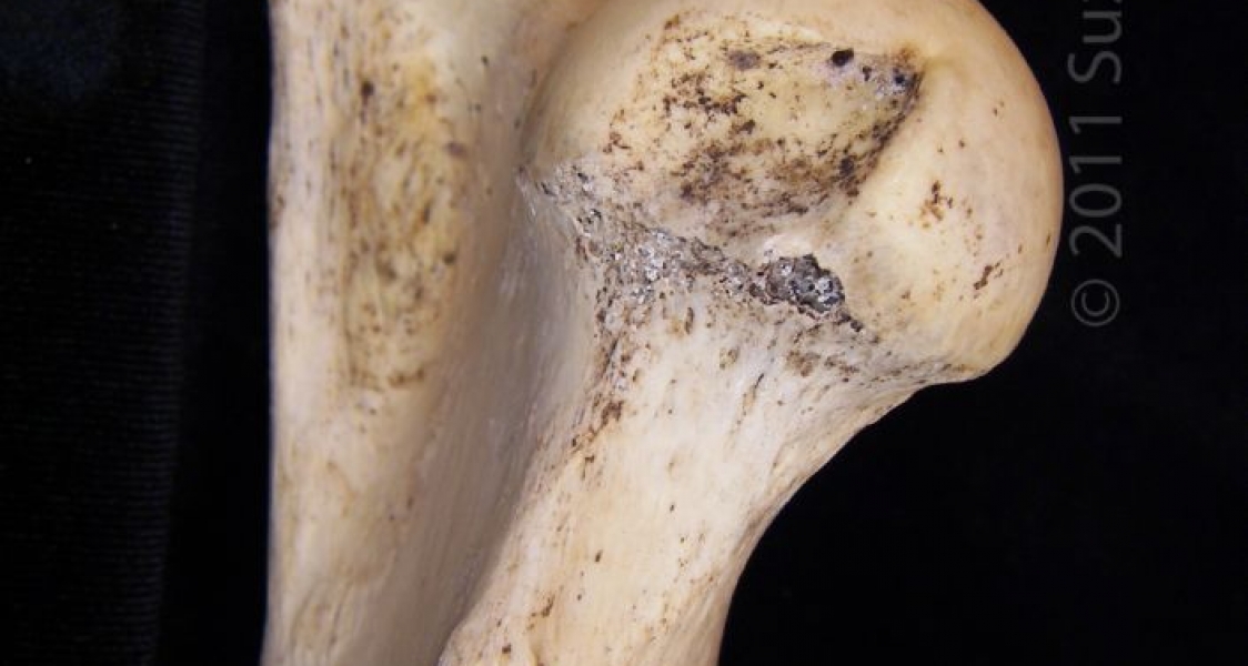 Medial View Proximal Surface Left Donkey Femoral Head