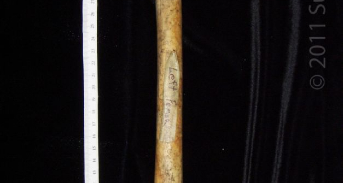 Anterior View Left Human Femur