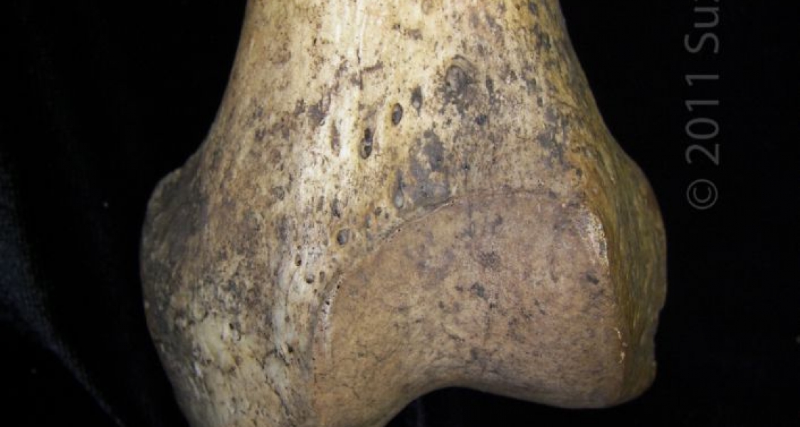 Anterior/Distal Aspect Left Human Femur