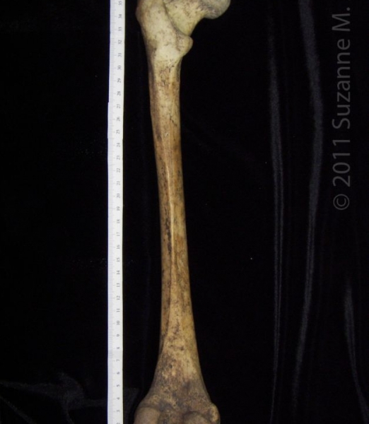 Posterior View Left Human Femur