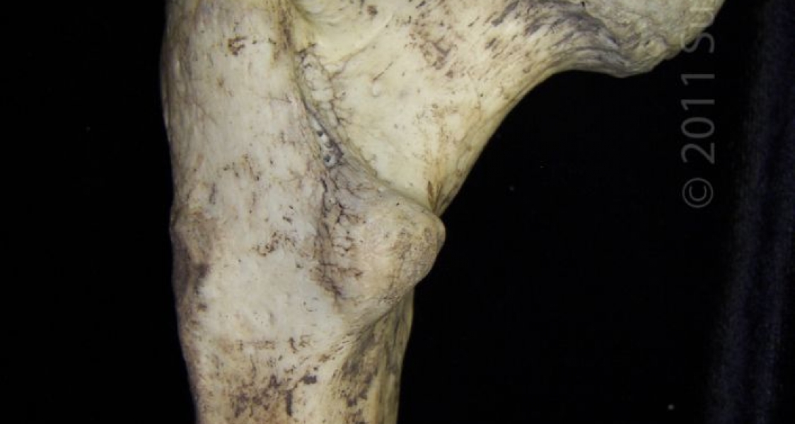 Proximal/Posterior Aspect Left Human Femur (Femoral Head)