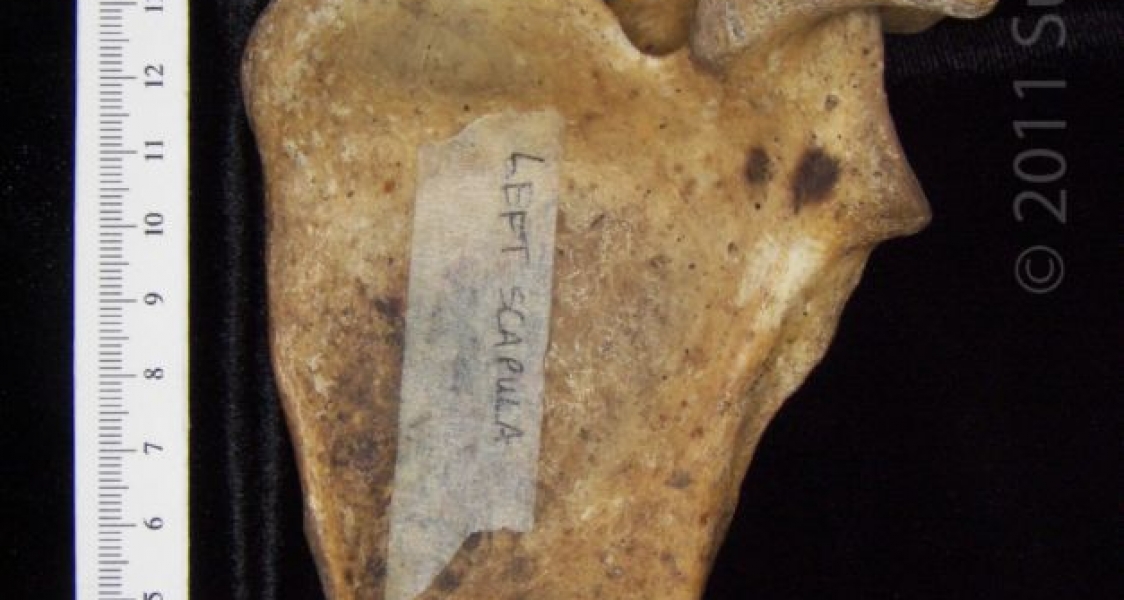 Anterior View Left Human Scapula