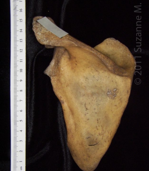 Posterior View Left Human Scapula