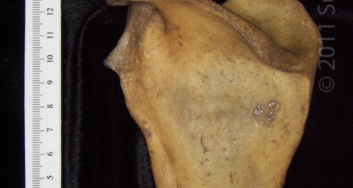 Posterior View Left Human Scapula