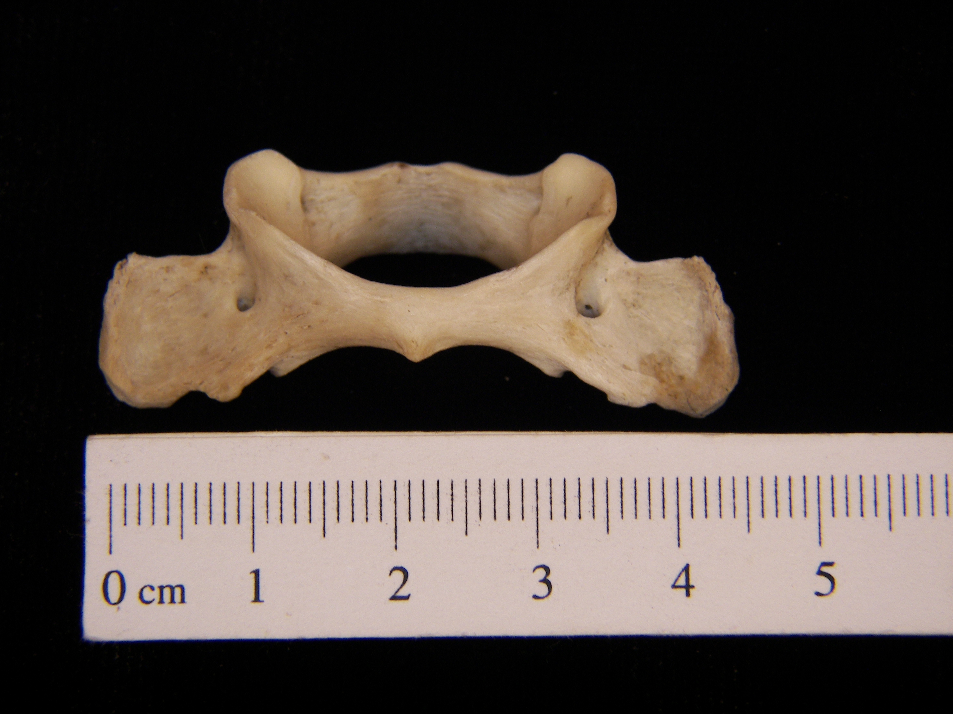 Raccoon (Procyon lotor) C2, inferior view